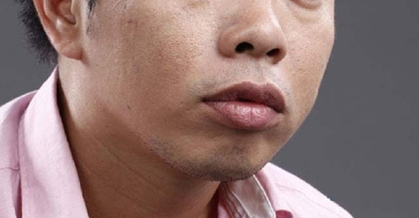 Cách Khắc Phục Môi Trề Gallery 1