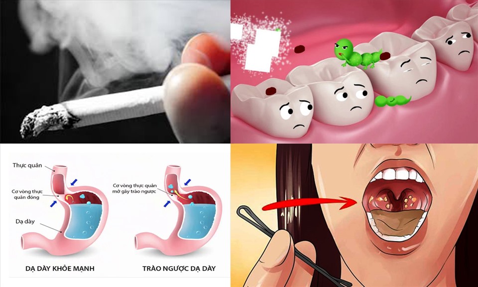 Miệng Có Mùi Hôi Thối: Nguyên Nhân, Cách Khắc Phục & Phòng Ngừa Gallery 1