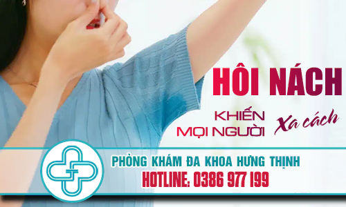 Mặc áo của người hôi nách có bị lây không? Gallery 1