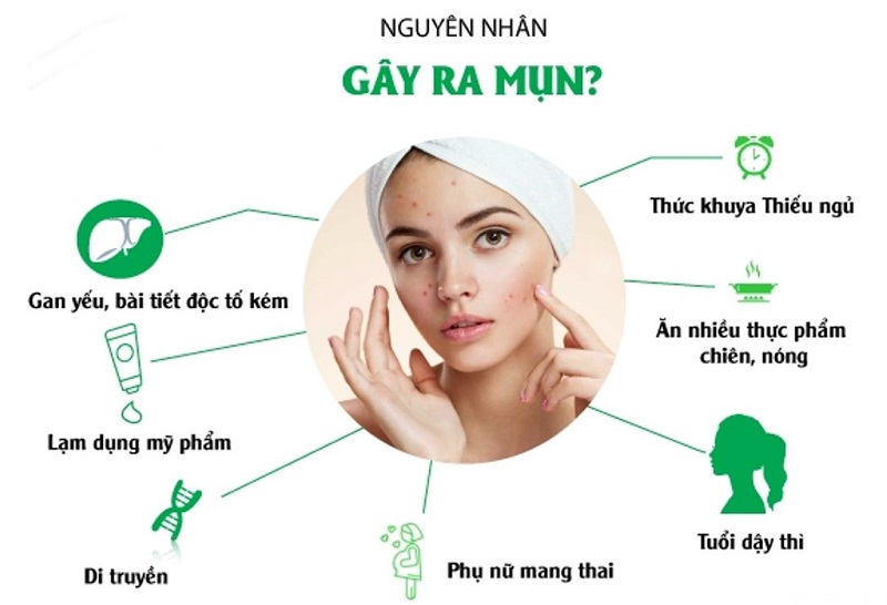 Cách Trị Mụn Hiệu Quả Và An Toàn Gallery 2