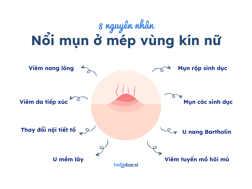 Mọc mụn ở cô bé Gallery 1