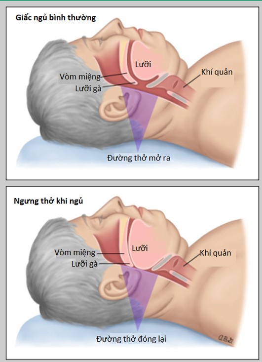 Ngủ Chập Chờn Hay Bị Tỉnh Giấc: Nguyên Nhân Và Cách Khắc Phục Gallery 1