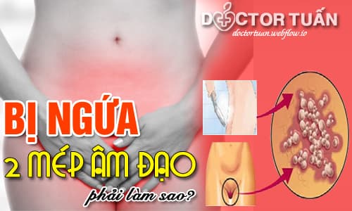 Ngứa Mép Âm Đạo Gallery 1