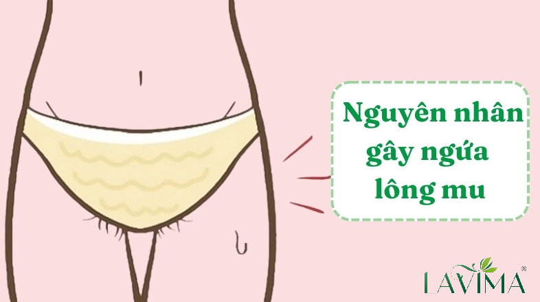 Ngứa Mu Vùng Kín: Nguyên Nhân và Cách Điều Trị Gallery 1
