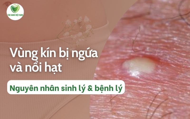 Vùng kín bị ngứa và nổi hạt: Nguyên nhân và cách điều trị Gallery 1