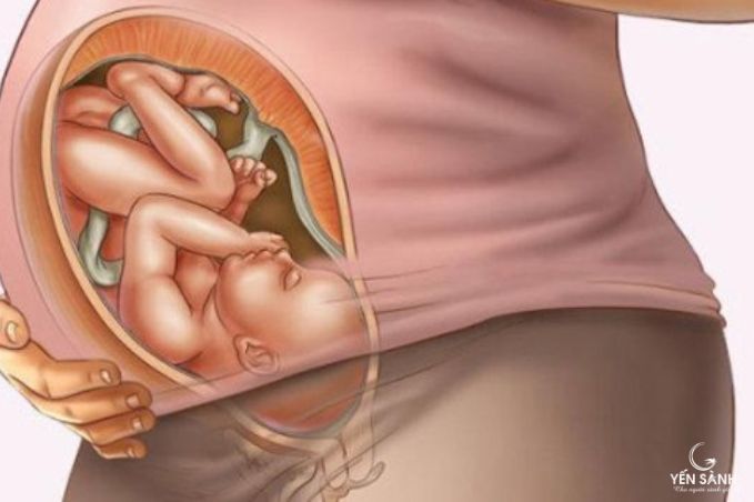 Nhói ở vùng kín khi mang thai tháng cuối: Nguyên nhân và cách xử lý Gallery 1