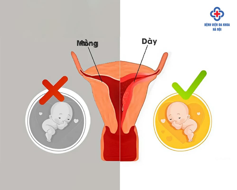 Niêm mạc tử cung mỏng: Nguyên nhân, triệu chứng và cách điều trị Gallery 1