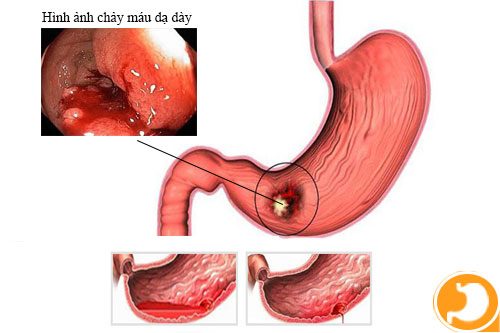 Niêm mạc xung huyết là gì? Gallery 1
