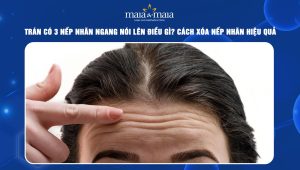 Trán Có 3 Nếp Nhăn Ngang: Nguyên Nhân Và Cách Khắc Phục Gallery 1