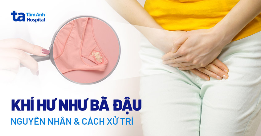 Bã trắng ở vùng kín: Nguyên nhân và cách xử lý Gallery 1