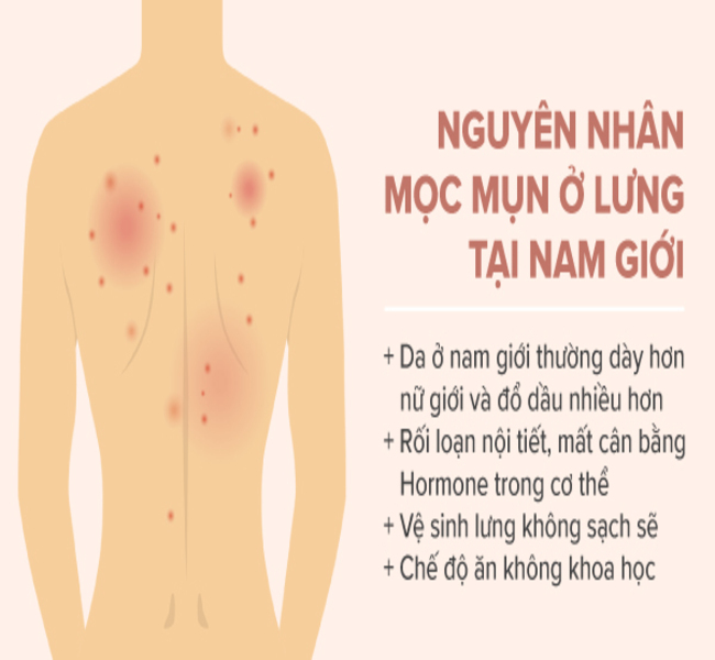 Mung Lung Là Gì? Gallery 1