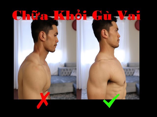 Cách Sửa Dáng Đi Xấu Gallery 1