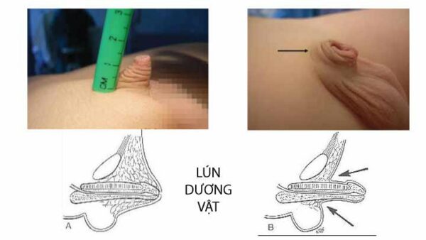 Thụt két là gì? Gallery 1
