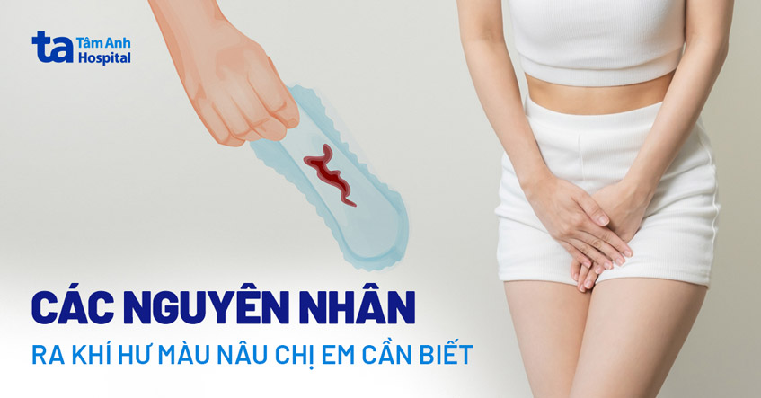 Khí hư màu nâu nhạt: Nguyên nhân và cách xử lý Gallery 1