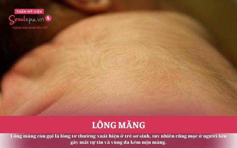 Lông măng ở lưng người lớn: Nguyên nhân, cách xử lý và điều cần biết Gallery 1