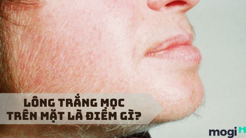 Lông tơ trắng trên mặt là gì? Nguyên nhân và cách xử lý Gallery 1
