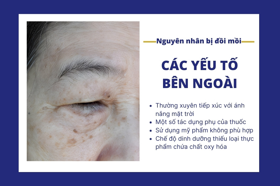 Mặt dỗi là gì? Nguyên nhân và cách xử lý Gallery 1