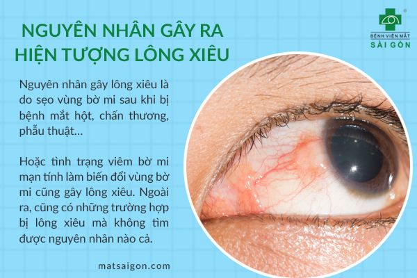 Mích lòng là gì? Gallery 1