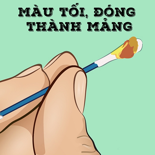 Ráy tai màu xanh: Nguyên nhân và điều cần làm Gallery 1