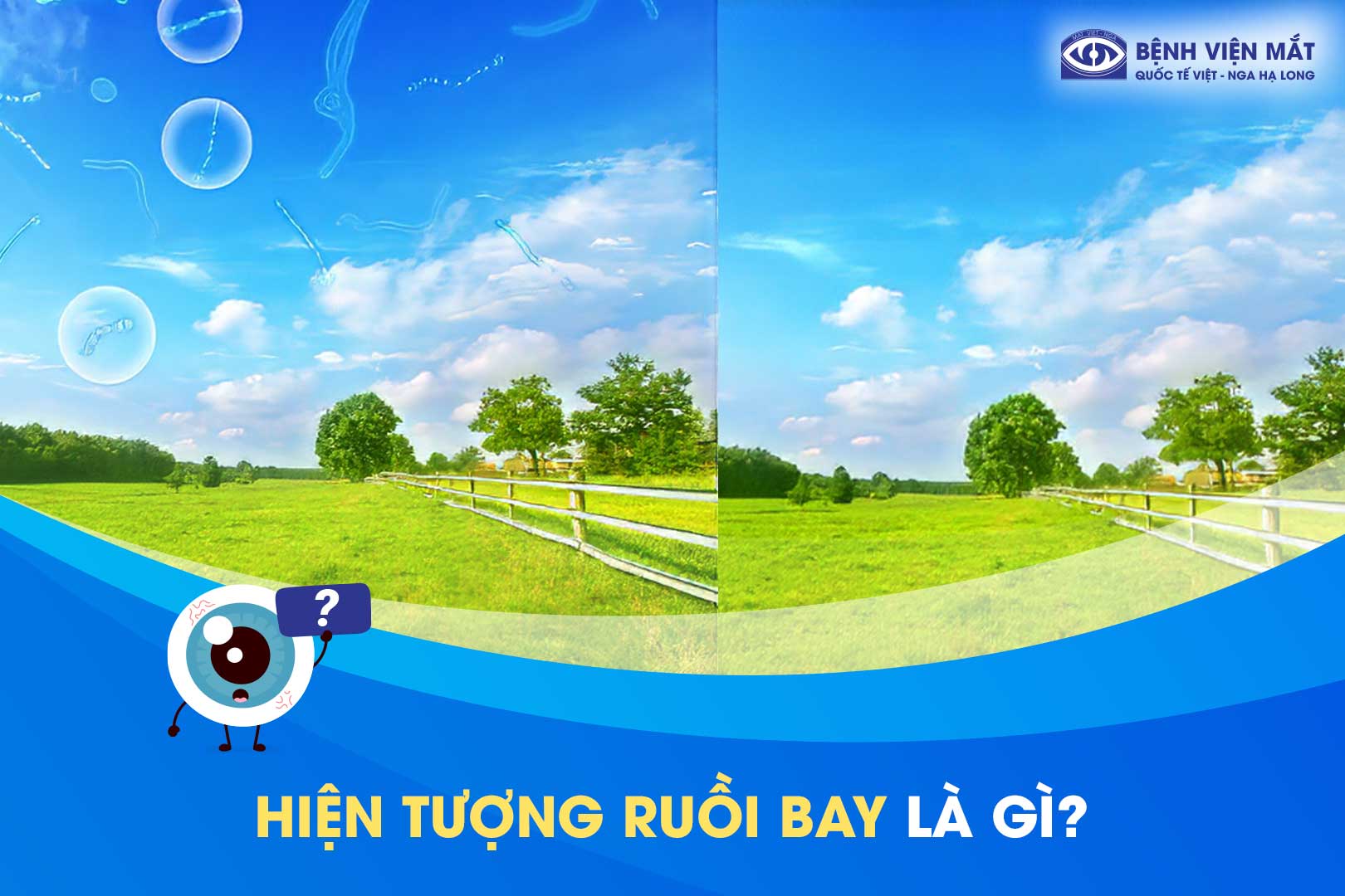 Cách Chữa Hiện Tượng Ruồi Bay Gallery 1