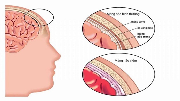 Sa Sút Là Gì? Nguyên Nhân, Biểu Hiện Và Cách Khắc Phục Gallery 1
