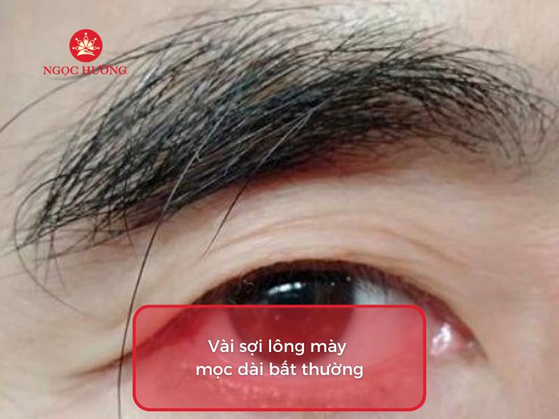 Một Sợi Lông Mày Dài Bất Thường Màu Trắng Gallery 1
