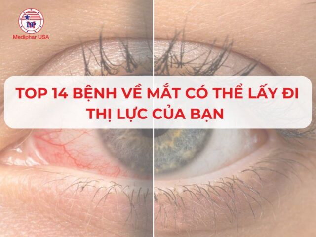 Mắt Díp Lại Là Gì? Nguyên Nhân Và Cách Khắc Phục Gallery 1