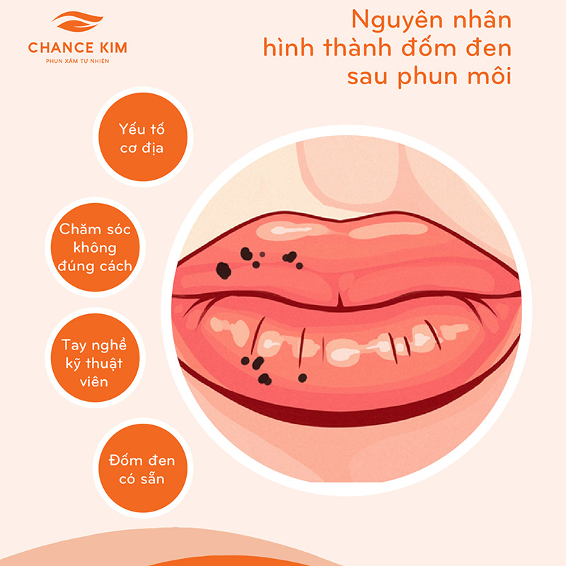 Phun môi bị đốm đen: Nguyên nhân và cách khắc phục Gallery 1