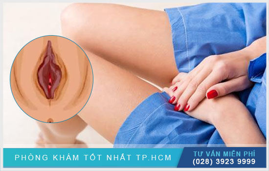 Sập Sệ Là Gì? Định Nghĩa, Nguyên Nhân Và Cách Khắc Phục Gallery 1