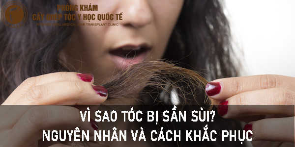 Sợi Tóc Bị Sần Sùi: Nguyên Nhân, Cách Chữa Trị và Phòng Ngừa Gallery 1