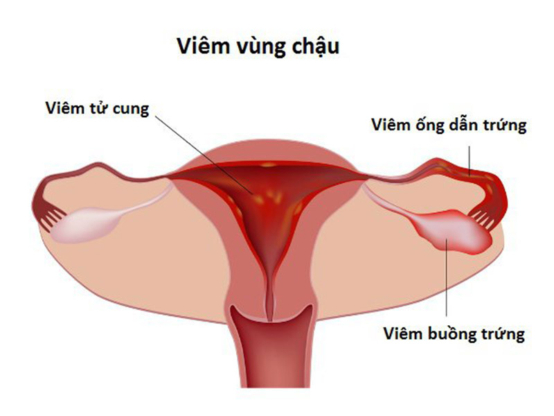 Tư Âm Là Gì? Gallery 2