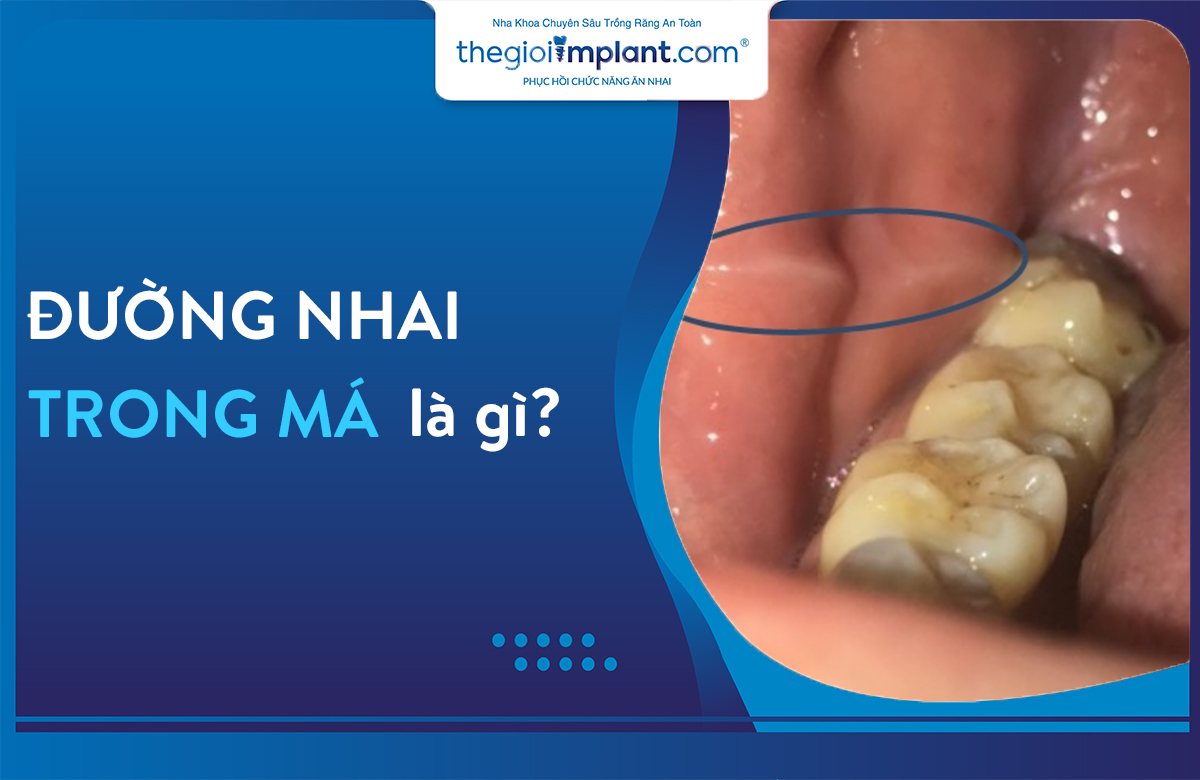 Vết Trắng Dài Hai Bên Má Trong Là Gì? Nguyên Nhân Và Cách Điều Trị Gallery 1
