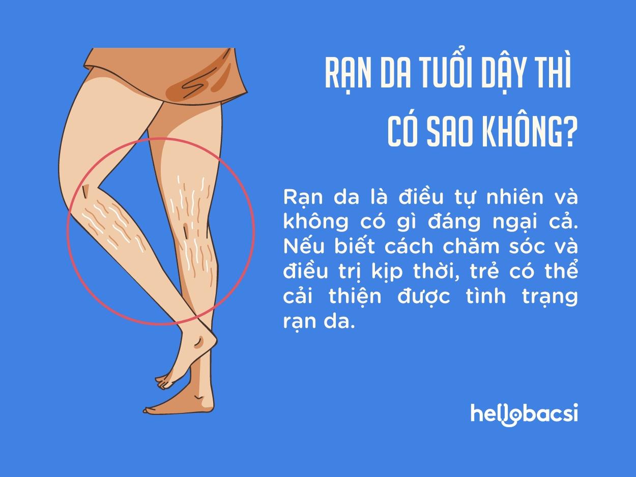 Rạn da chân tuổi dậy thì: Nguyên nhân, phòng ngừa và điều trị Gallery 1