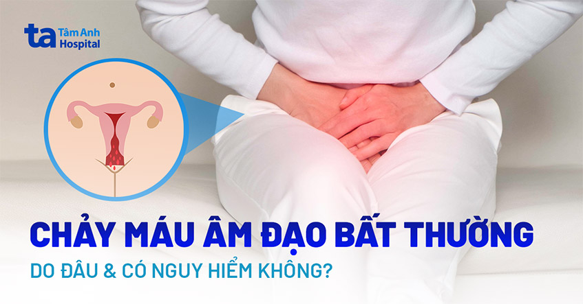 Rỉ Máu Vùng Kín: Nguyên Nhân, Triệu Chứng Và Cách Xử Trí Gallery 1
