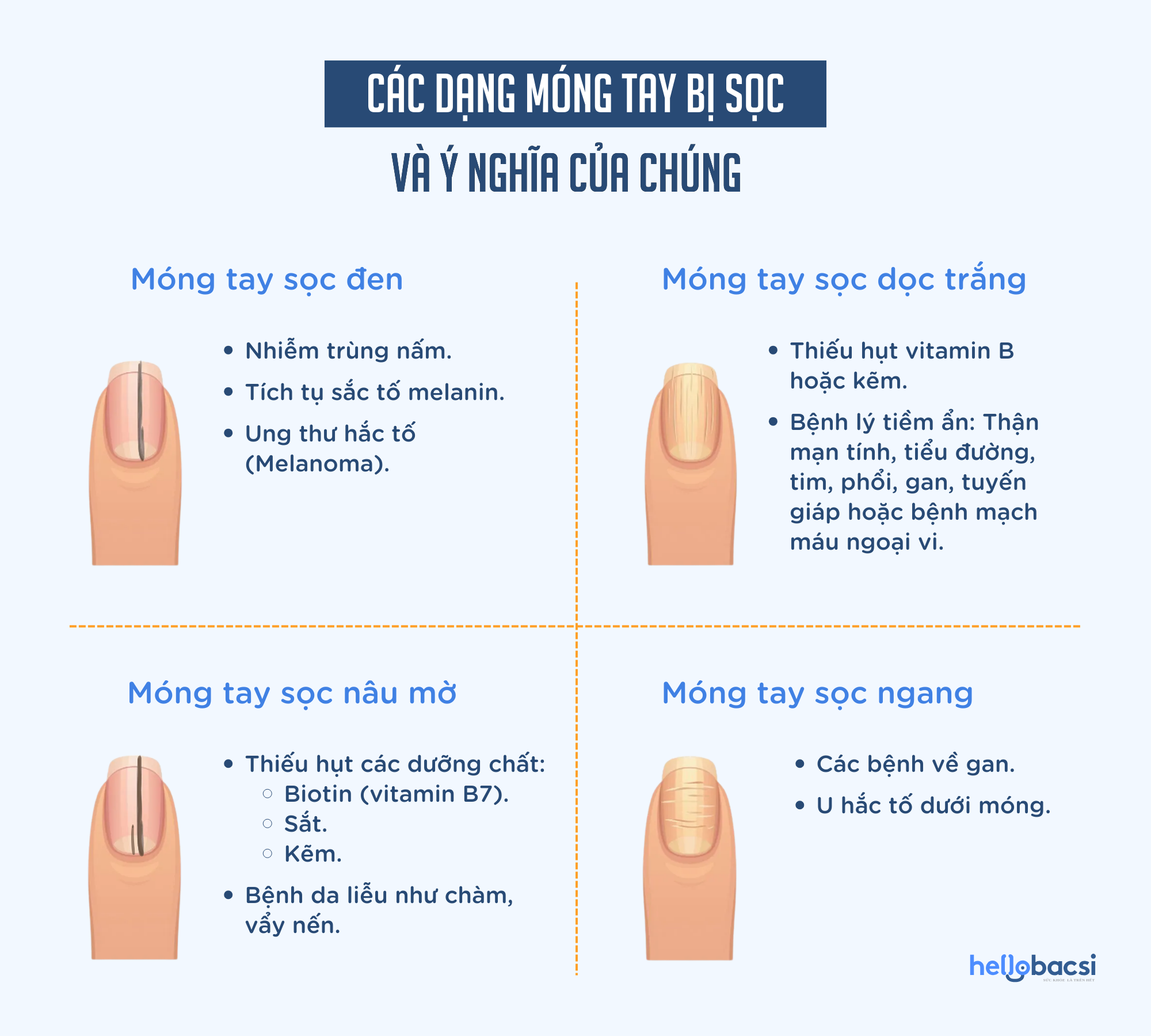 Móng Tay Bị Sọc Nâu: Nguyên Nhân Và Cách Khắc Phục Gallery 1