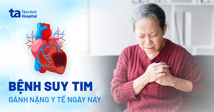 Bài Giảng Suy Tim: Hiểu rõ nguyên nhân, triệu chứng và cách điều trị Gallery 1