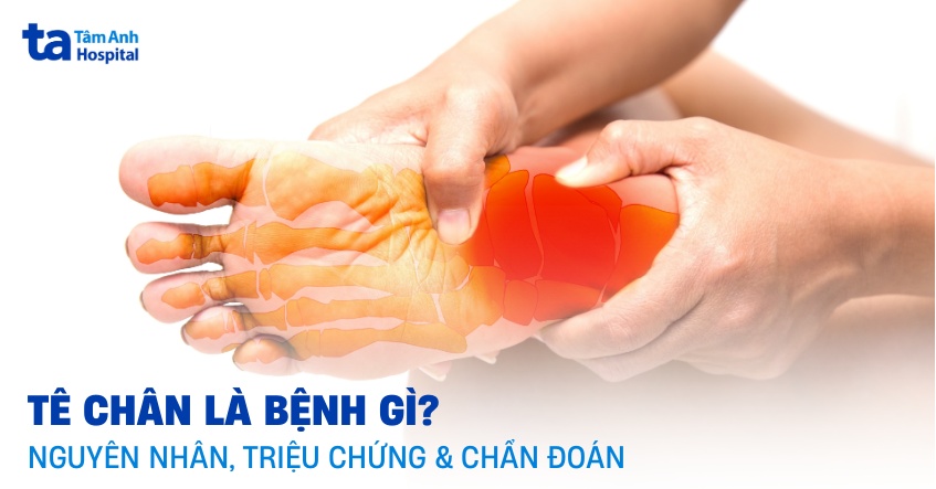 Ngủ dậy bị tê chân: Nguyên nhân và cách khắc phục Gallery 1