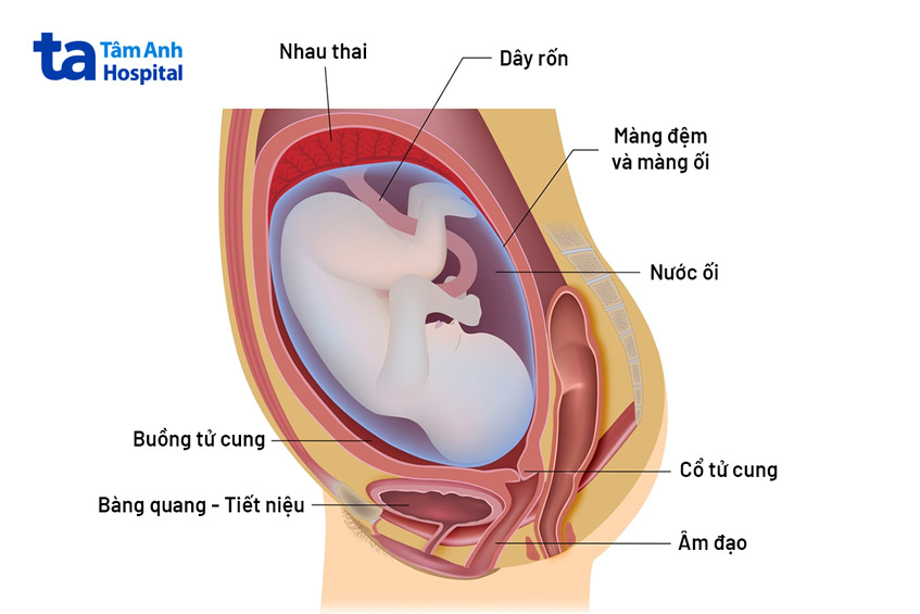 Thiếu ối phải làm sao? Gallery 1