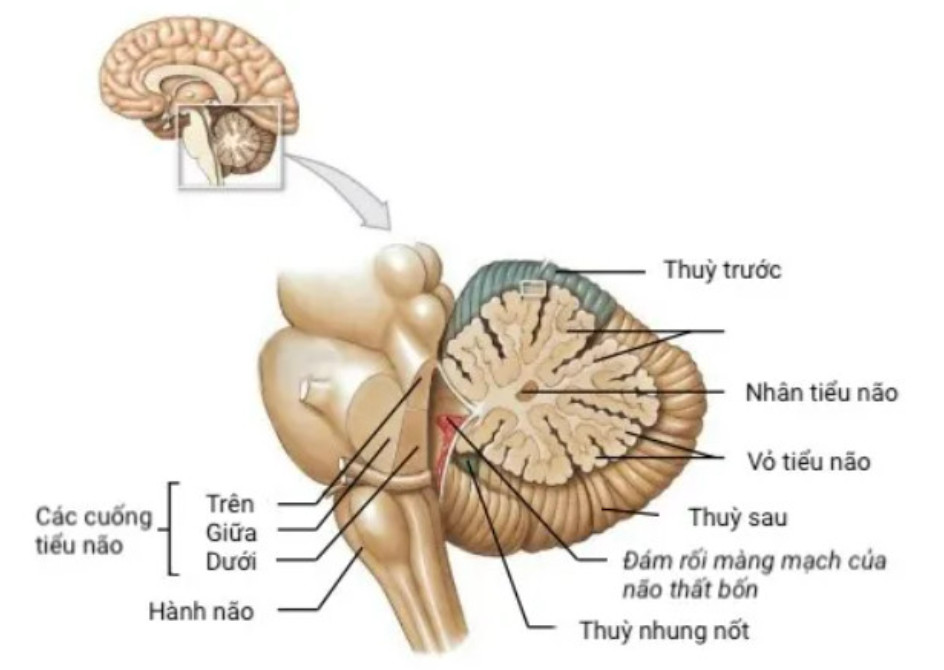 Thoái Hóa Tiểu Não Gallery 1