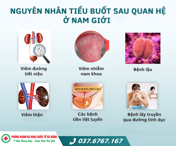 Tiểu Rắt Sau Quan Hệ: Nguyên Nhân, Cách Khắc Phục và Phòng Ngừa Gallery 1