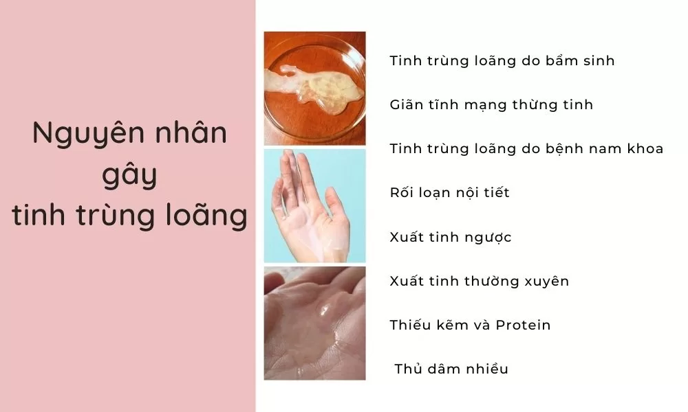 Tinh trùng loãng là gì? Gallery 1