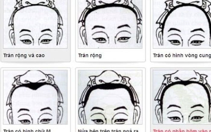 Trán Nhô Ra Phía Trước: Nguyên Nhân và Cách Khắc Phục Gallery 1