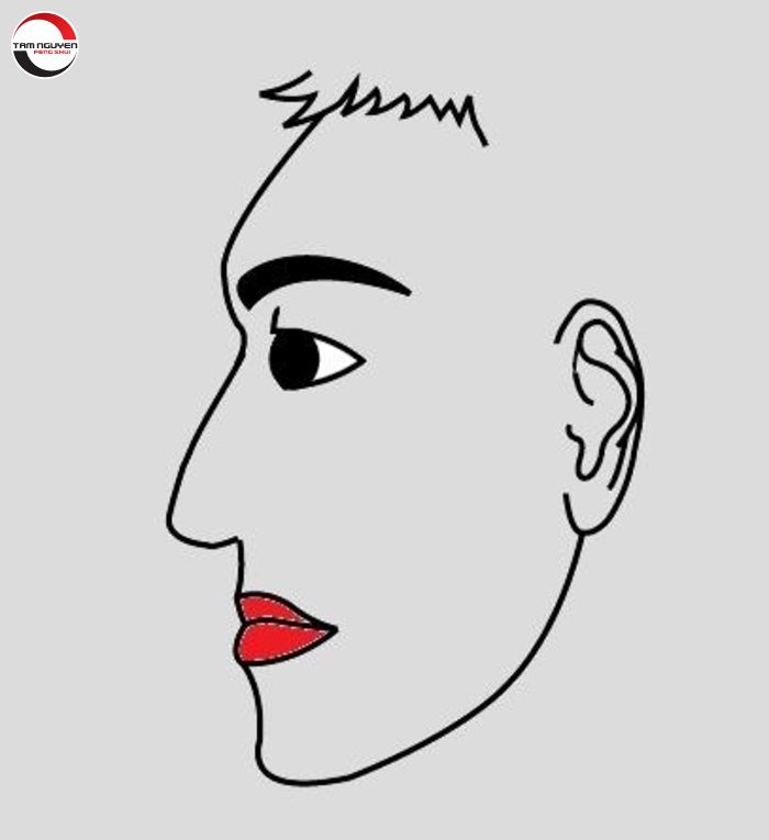 Trán Vát Về Sau: Nguyên Nhân, Ảnh Hưởng và Cách Khắc Phục Gallery 1