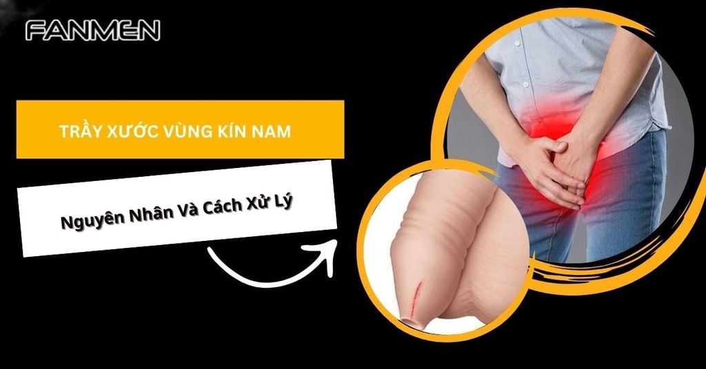 Trầy trật là gì? Nguyên nhân, cách khắc phục và phòng ngừa Gallery 1