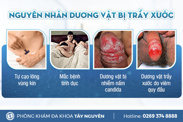 Trầy Xước: Nguyên Nhân, Cách Điều Trị và Phòng Ngừa Gallery 1