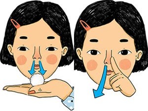 Xì mũi nhiều bị ù tai: Nguyên nhân và cách khắc phục Gallery 1