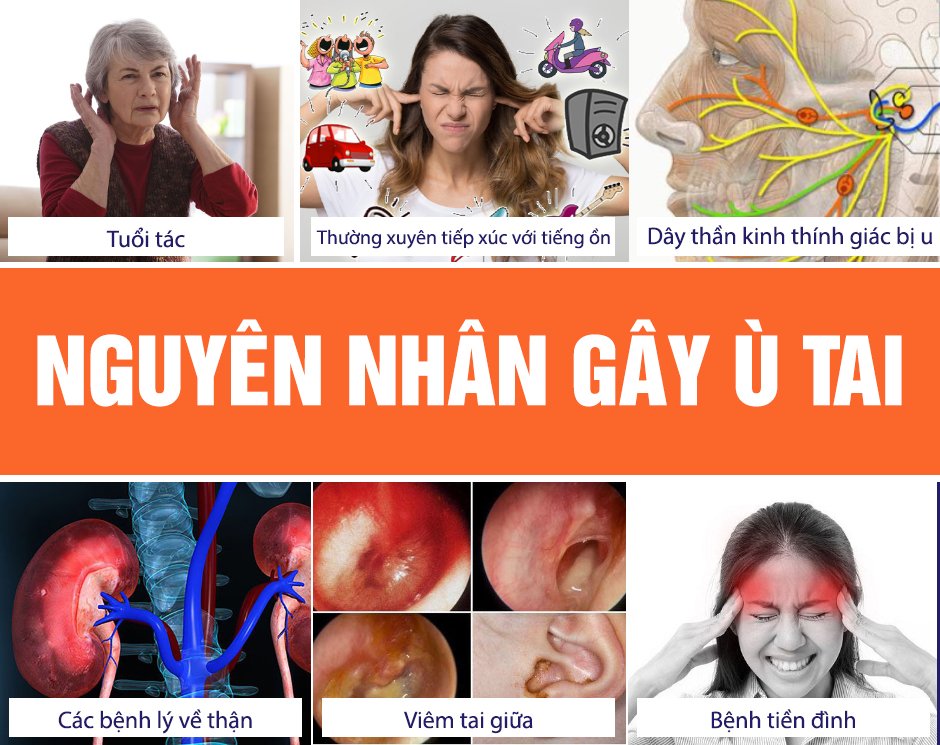Cách Trị Ù Tai, Ve Kêu Hiệu Quả Gallery 1