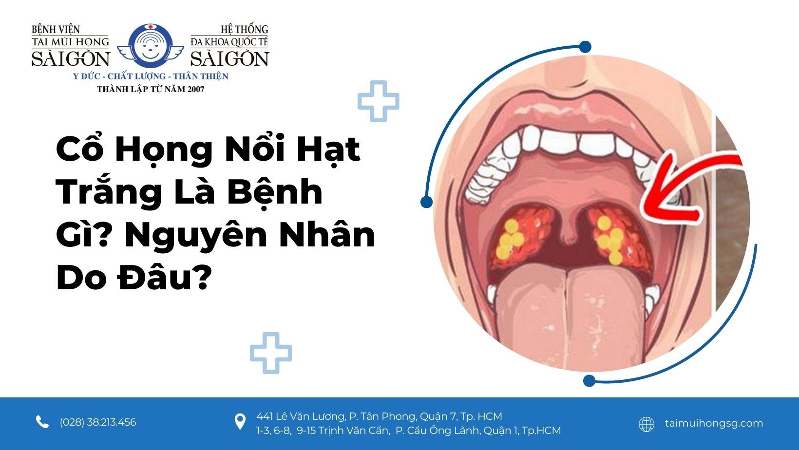 Vòm họng nổi hạt trắng là bệnh gì? Gallery 1