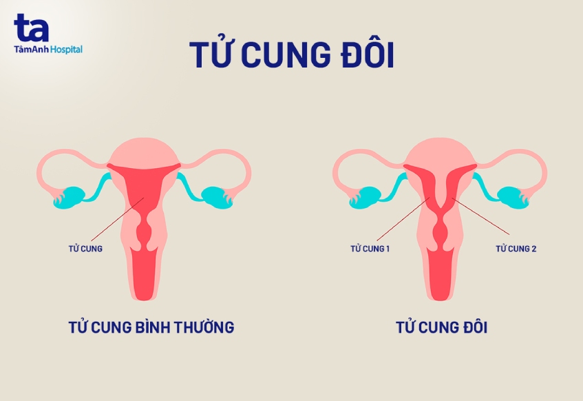 Hiện tượng xảy thai: Nguyên nhân, triệu chứng và cách phòng ngừa Gallery 1