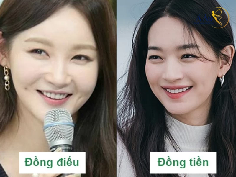 Má lúm ở dưới miệng Gallery 1